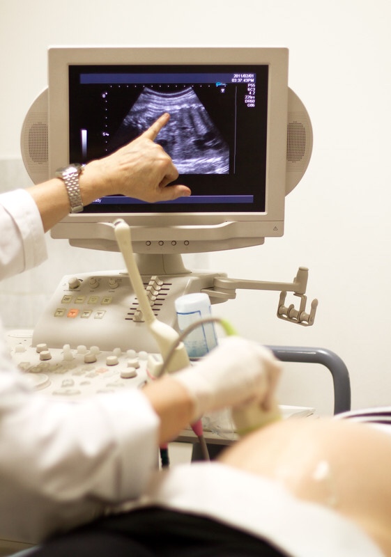 Pregnant woman getting ultrasound